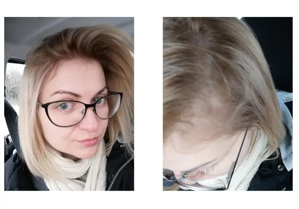 Skuteczne sposoby na włosy blond bez żółtego odcienia - najlepsze metody
