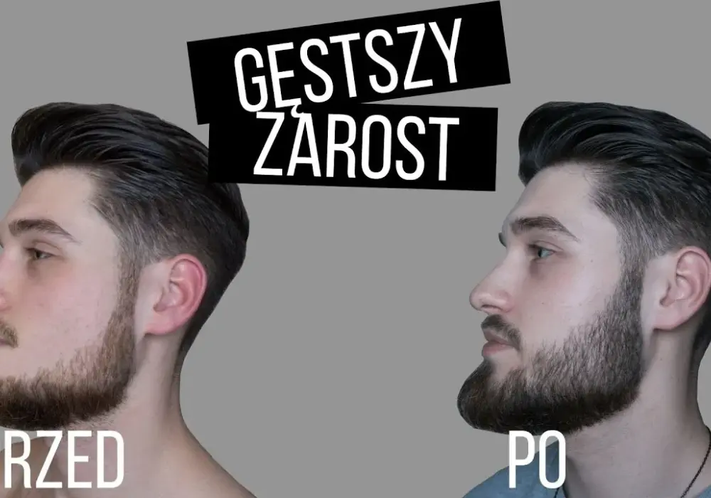 Jak naturalnie zwiększyć zarost? Sprawdzone sposoby na gęstą brodę