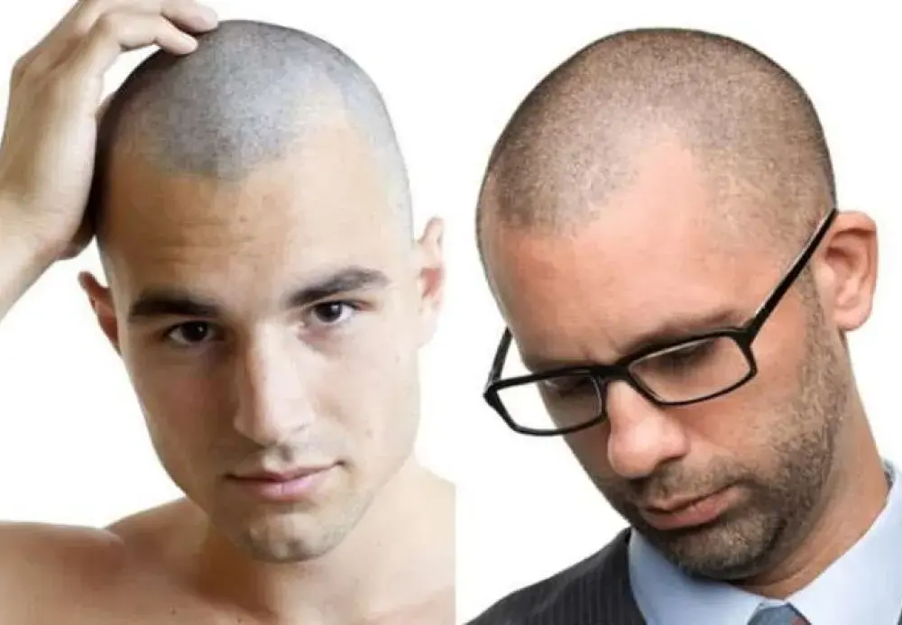 Fryzura na zero! Oto nasz kompletny poradnik dla tych, co lubią krótko
