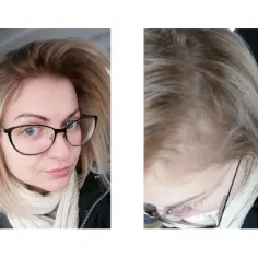 Skuteczne sposoby na włosy blond bez żółtego odcienia - najlepsze metody