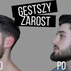 Jak naturalnie zwiększyć zarost? Sprawdzone sposoby na gęstą brodę