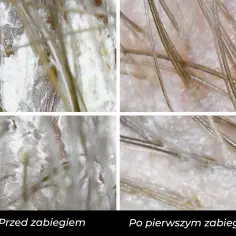 Jak prawidłowo wykonać peeling skóry: kompletny poradnik dla każdego